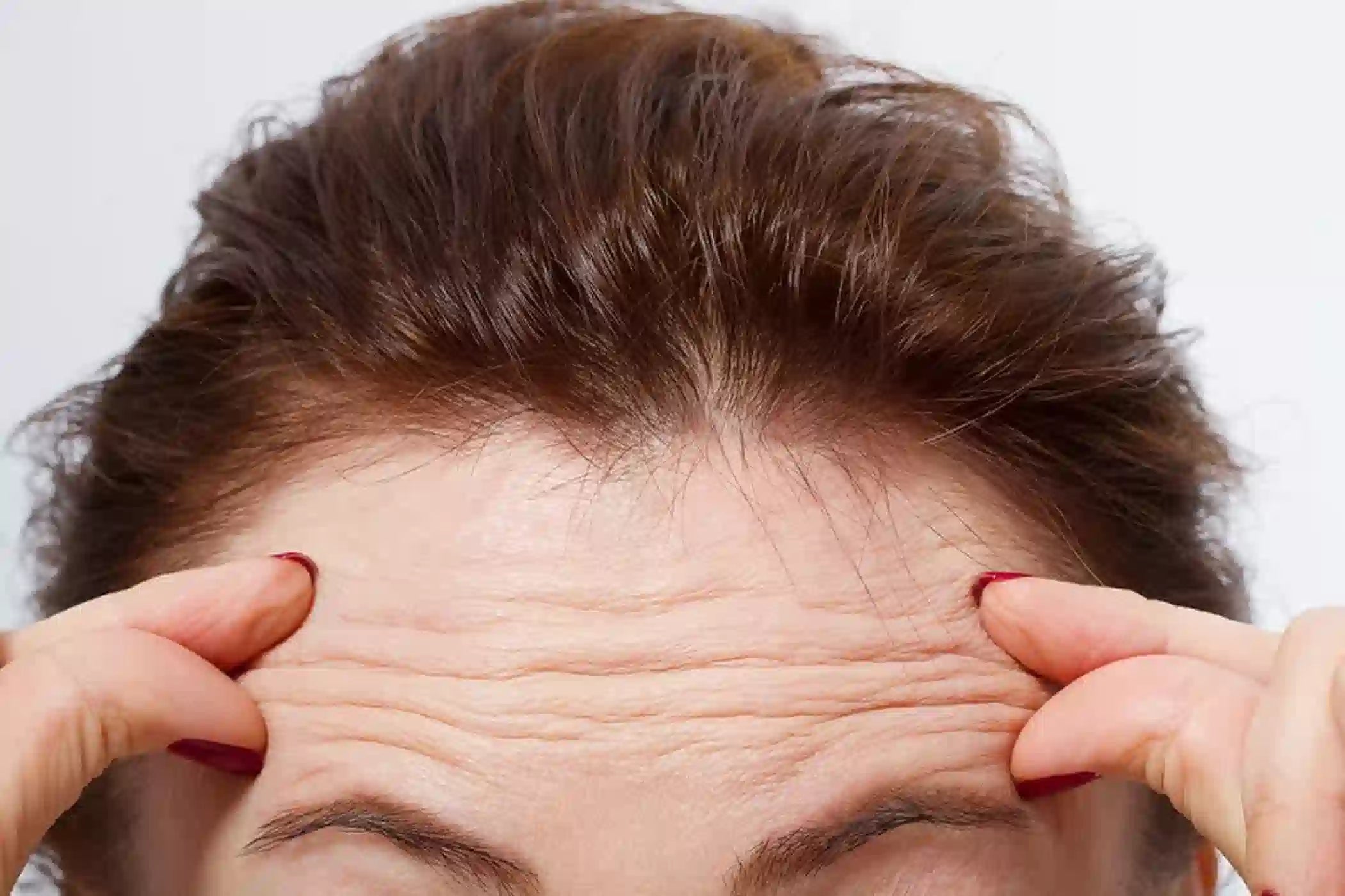 How to Get Rid of Forehead Wrinkles in 2026: The Complete Guide