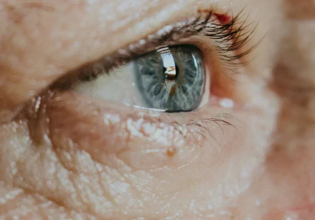 How to Get Rid of Under Eye Wrinkles in 2026: 12 Proven Ways