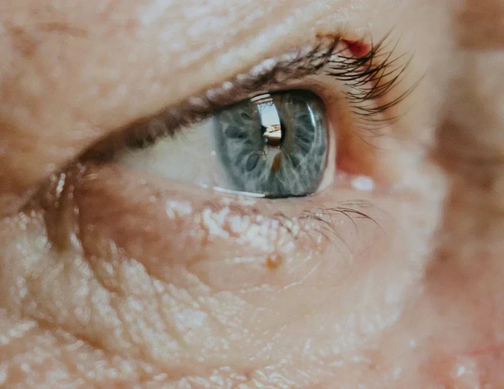 How to Get Rid of Under Eye Wrinkles in 2026: 12 Proven Ways