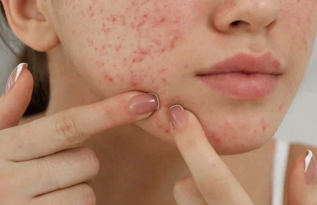 Moonchild® Sustainable Silk Pillowcase