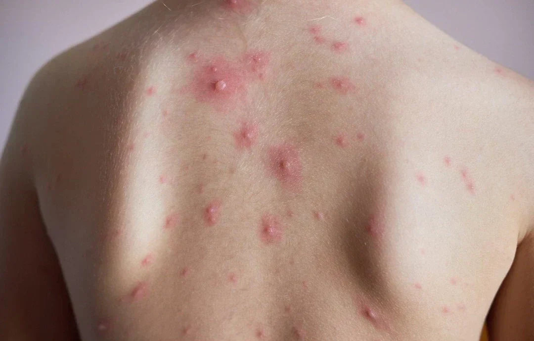 Moonchild® Sustainable Silk Pillowcase