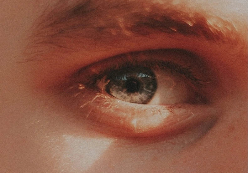 How to Get Rid of Puffy Eyes Fast: 17 Doctor-Approved Remedies & Cremes
