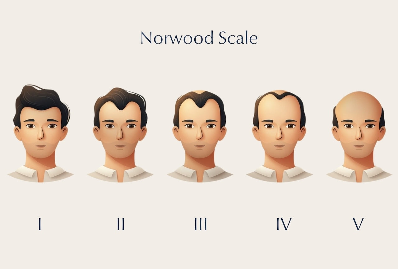 Male Pattern Baldness 2026: Causes & Treatments