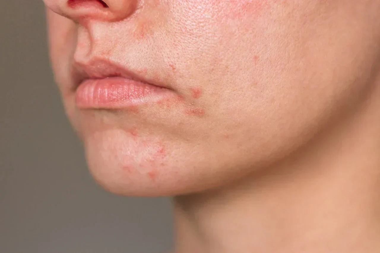 Moonchild® Sustainable Silk Pillowcase