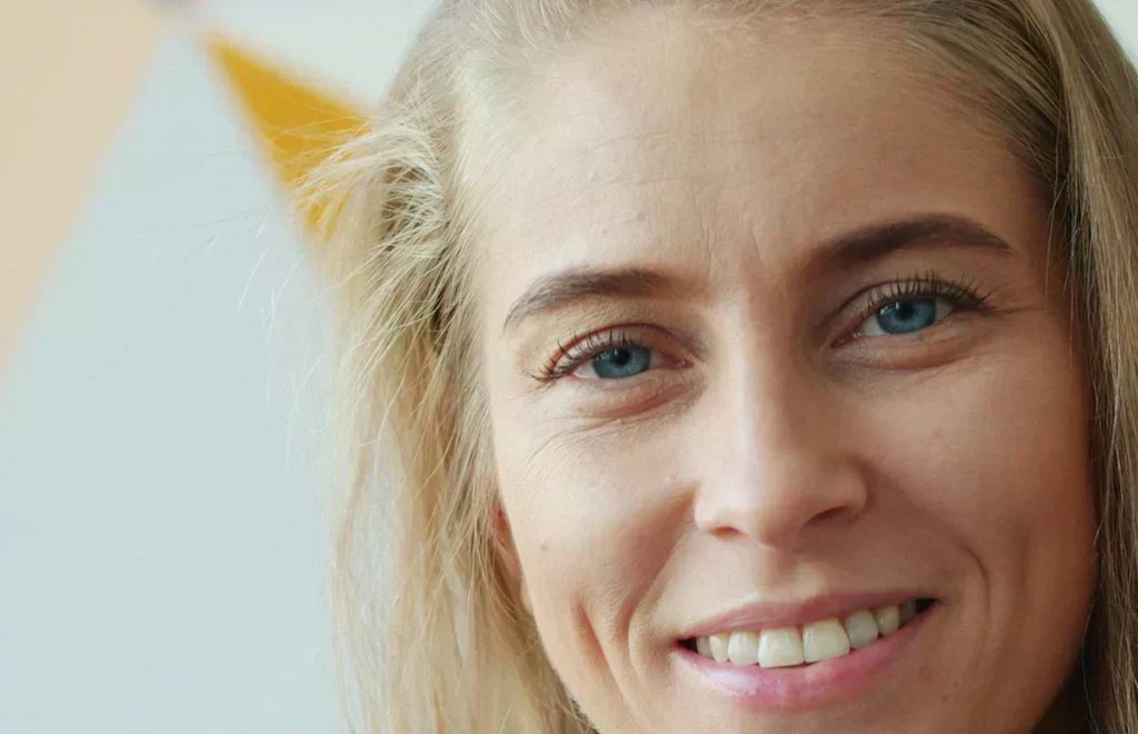 What Causes Wrinkles?